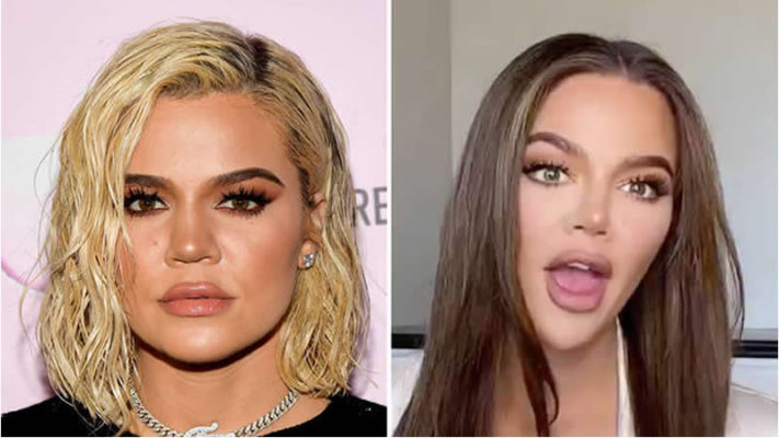 Khloé Kardashian Opens Up About the Plastic Surgery Behind Her ‘New Face’