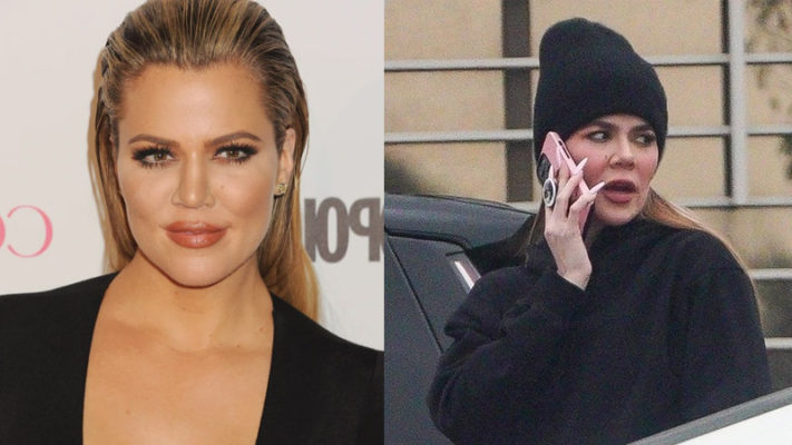 Khloe Kardashian Looks 'nearly Unrecognizable' And Has A 'less Natural ...