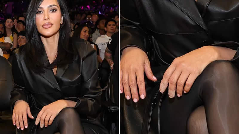 Kim Kardashian Finger Injury