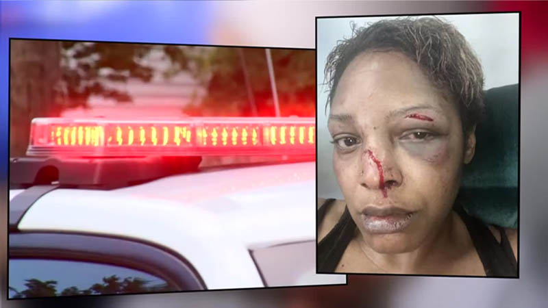 Mother Recounts Vicious Attack